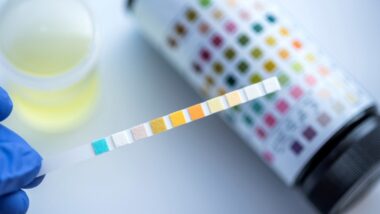 How drug testing works? (A step-by-step guide)